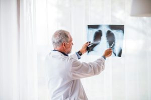 digital xray, Digital X-Rays