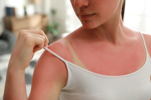Summer Injuries